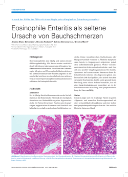 Eosinophile Enteritis als seltene Ursache von Bauchschmerzen