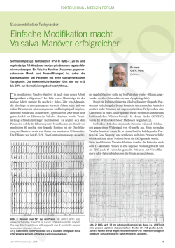 Einfache Modifikation macht Valsalva