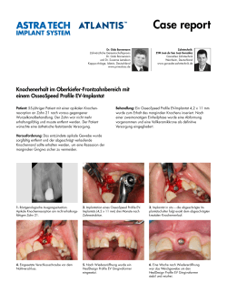 PDF anzeigen - DENTSPLY Implants
