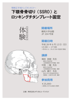 下顎骨骨切り （SSRO） と ロッキングチタンプレート固定