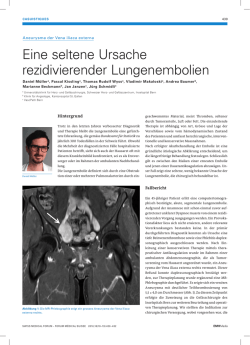 Eine seltene Ursache rezidivierender Lungenembolien