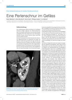 Eine Perlenschnur im Gef&auml;ss