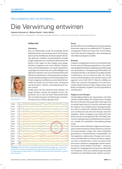 Die Verwirrung entwirren