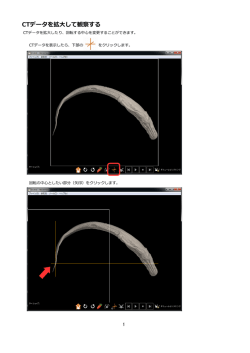 CTデータを拡大して観察する