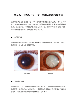 フェムトセカンドレーザー白内障手術パンフレット（PDF）