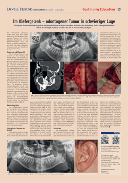 Im Kiefergelenk – odontogener Tumor in schwieriger Lage