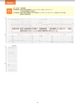 妊娠35週： 胎児心拍数基線は正常脈で、基線細変動､ 一過性頻脈ともに