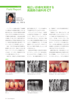 幅広い診療を実現する 高画質の歯科用 CT