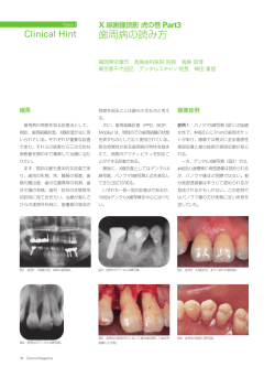歯周病の読み方