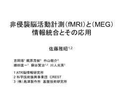 VBMEG:階層ベイズ電流源推定法解説