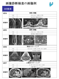 画像診断検査の画像例 MR検査