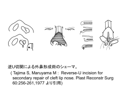 われわれの再建術の試み