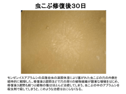 虫こぶ修復後2日 虫こぶ修復後9日 虫こぶ修復後14日 虫こぶ修復後