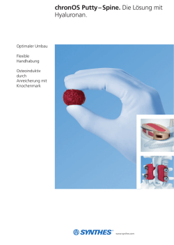 chronOS Putty &ndash; Spine. Die L&ouml;sung mit Hyaluronan.