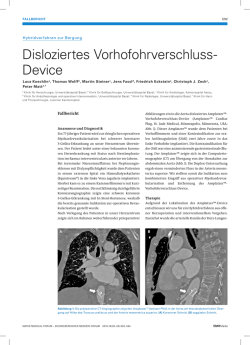 Disloziertes Vorhofohrverschluss- Device