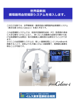 循環器用血管撮影システム