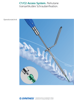 C1/C2 Access System. Perkutane transartikuläre Schraubenfixation.