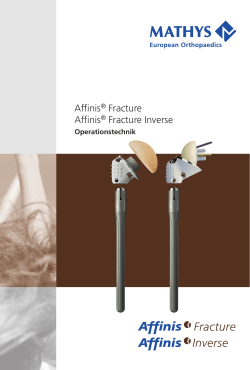 Affinis® Fracture Affinis® Fracture Inverse