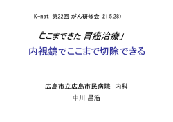 内視鏡でここまで切除できる