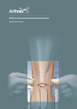 PARS Achillessehnenrekonstruktionssystem