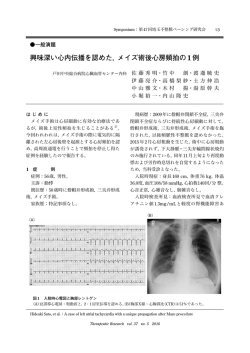 興味深い心内伝播を認めた，メイズ術後心房頻拍の1例