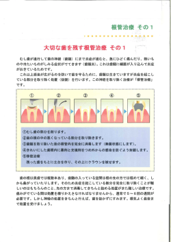 歯のおはなし 根管治療 その1