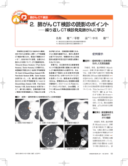 2． 肺がんCT検診の読影のポイント