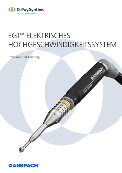 EG1&trade; ELEKTRISCHES HOCHGESCHWINDIGKEITSSYSTEM