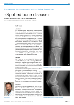 Spotted bone disease - Swiss Medical Forum
