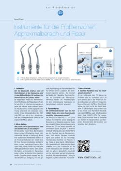 Instrumente f&uuml;r die Problemzonen Approximalbereich