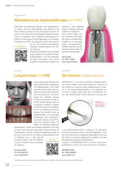Minimalinvasive Implantattherapie mit K3Pro