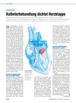 Katheterbehandlung dichtet Herzklappe