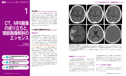 CT，MRI画像 の成り立ちと， 頭部画像解剖の エッセンス
