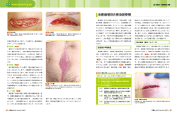 治癒過程別の感染創管理
