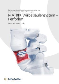 MATRIX Wirbelsäulensystem – Perforiert