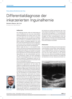 Differentialdiagnose der inkarzerierten Inguinalhernie