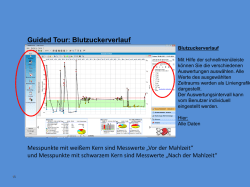 Guided Tour: Blutzuckerverlauf