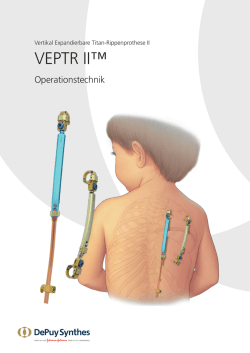VEPTR II™