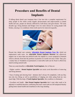 Procedure and Benefits of Dental Implants