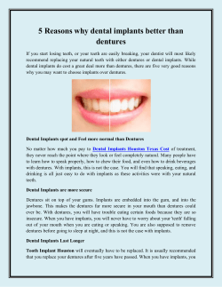 5 Reasons why dental implants better than dentures