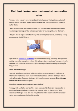 Find best broken vein treatment at reasonable rates