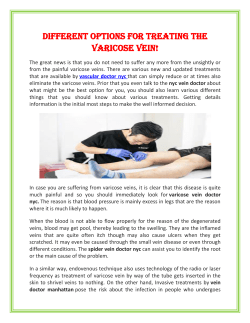 Different options for treating the Varicose Vein