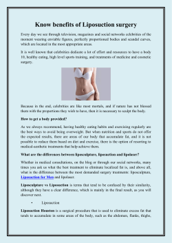 Know benefits of Liposuction surgery