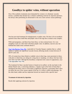 Goodbye to spider veins, without operation
