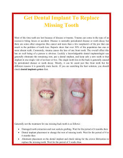Get Dental Implant To Replace Missing Tooth